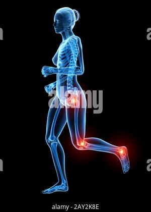 Painful Knee Joints Illustration Stock Photo Alamy