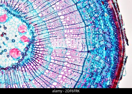 Eudicot Stem Ranunculus Sp Showing Epidermis Collenchyma Cortex