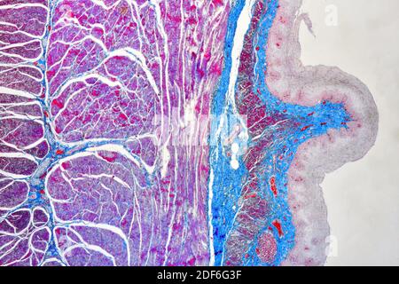 Human Esophagus Or Oesophagus Showing Squamous Epithelium Stratified