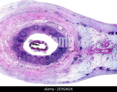 Human Vermiform Appendix Cross Section Showing Bottom To Top