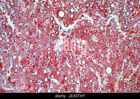 Liver Cells Light Micrograph Stock Photo Alamy