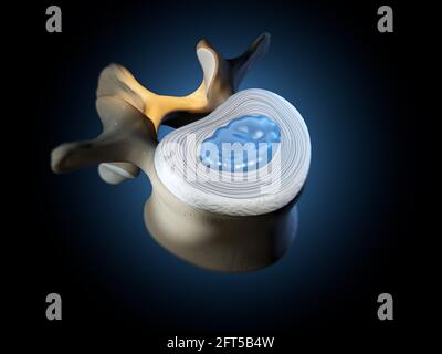 Illustration Showing Lumbal Vertebra With Intervertebral Disc And