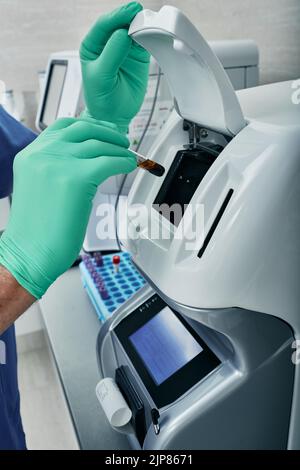 The Erythrocyte Sedimentation Rate Esr Test Stock Photo Alamy