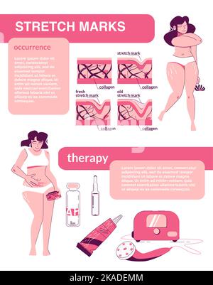 Stretch Marks Flat Infographic Composition With Editable Text And