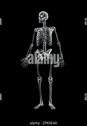 Accurate Xray Of Anterior View Of Full Human Skeletal System With Adult