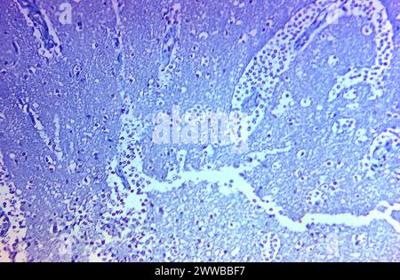 This Photomicrograph Of A Trichrome Stained Specimen Revealed Some Of