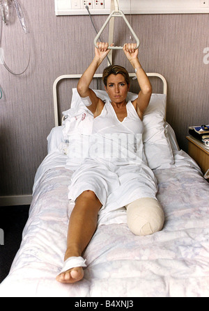 Heather Mills Model Had Leg Amputated After Accident Uses A Heat Lamp On The Stump Of Her Leg