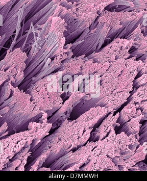 Tendon Coloured Scanning Electron Micrograph SEM Showing Bundles Of