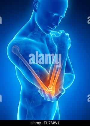 Human Elbow Pain Computer Illustration Stock Photo Alamy