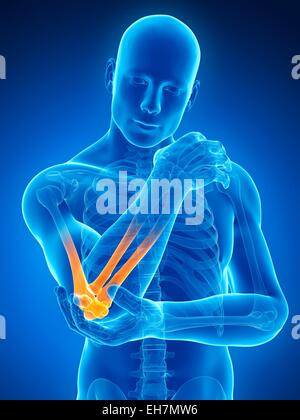 Human Elbow Joint Computer Illustration Stock Photo Alamy