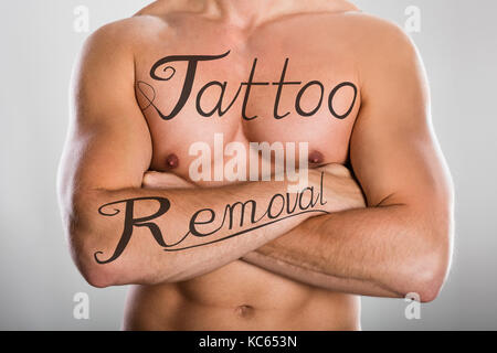 tattoo removal stock photo royalty free image 72477820 alamy tattoo removal stock photo royalty free image 72477820 alamy