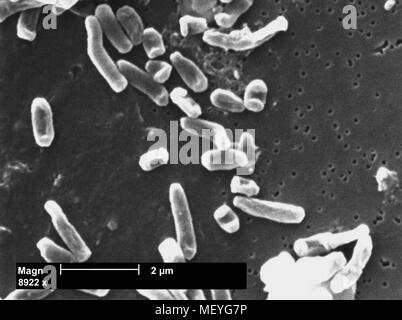 Scanning Electron Micrograph Sem Of Mycobacterium Chelonae A Type Of