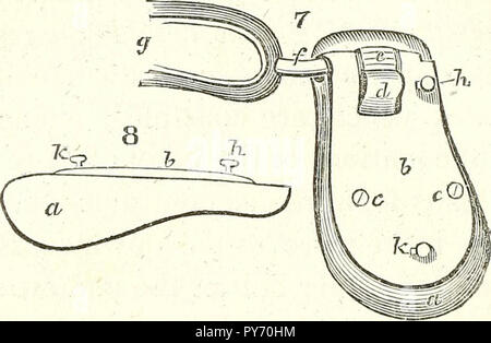 Treatise On The Radical Cure Of Hernia By Instruments Embracing An