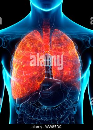 Pneumoconiosis Lung Disease Illustration Stock Photo Alamy