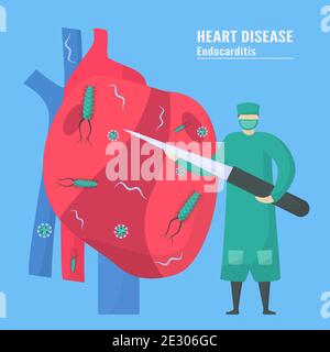 Tratamiento De Cardiolog A Esta Enfermedad Llama Endocarditis Es Una