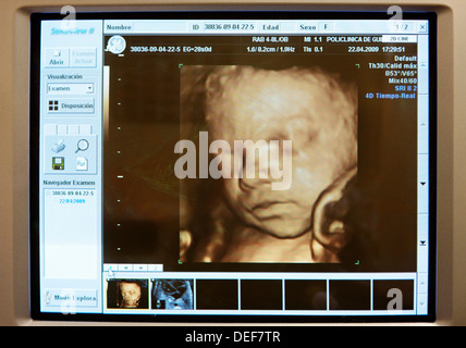 El Ultrasonido Obst Trico D De Un Feto D Baby Scan Que Muestran