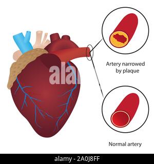 Cholesterol level in blood vessel vector illustration Stock Vector