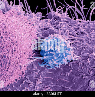 Prostate cancer cells, SEM Stock Photo