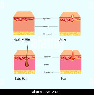 Vector illustration of types of skin problems isolated Stock Vector