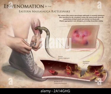 Medical illustration depicting the effects of envenomation by the eastern massasauga rattlesnake. Stock Photo