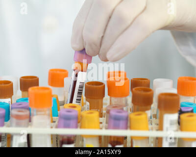 Close up of medical technican preparing samples for automated analysis in the lab Stock Photo