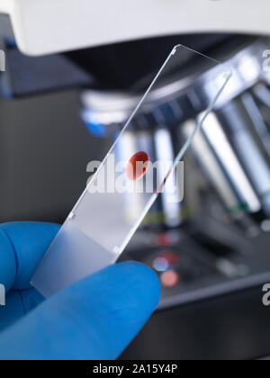 Scientist examining a glass slide containing a human sample under a microscope Stock Photo