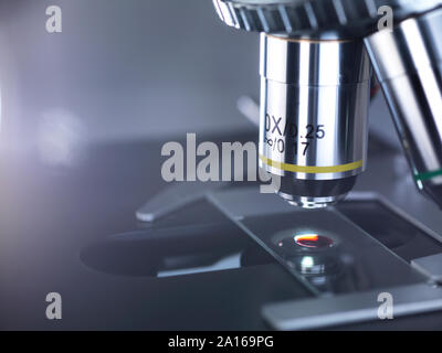 Human sample on a glass slide under a microscope in the laboratory Stock Photo