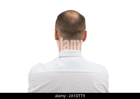 Human alopecia or hair loss - adult men bald head. back of balding man from shoulders isolated on white background. Stock Photo