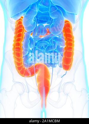 Ulcerative colitis as an inflammatory intestine with healthy and ...