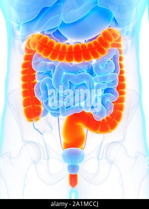 Ulcerative colitis as an inflammatory intestine with healthy and ...