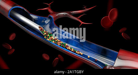 3d Illustration of Injection in the vein with vitamin Stock Photo