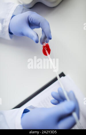Close-up of doctor wearing protective gloves holding glass with blood sample in his hands and holding medical exam at the lab Stock Photo