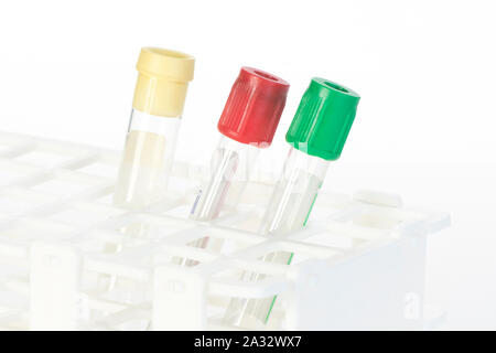 Close up of red, green and yellow blood collection tubes on rack. Stock Photo