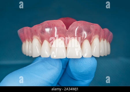 denture. Full removable denture of the upper jaw of man with white beautiful teeth in the hand of a dentist. Aesthetic Dentistry Stock Photo