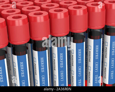 3d render of  blood samples with herpes test in row Stock Photo