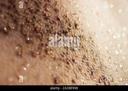 Close up photo of many moles on skin Stock Photo