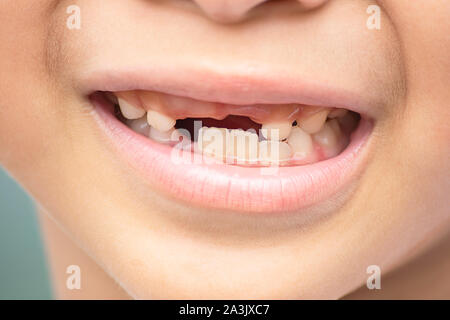 Baby teeth are just dropped in the mouth. Stock Photo