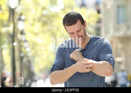 Overwhelmed adult man scratching itchy arm standing in the street Stock Photo