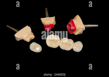 Dental veneers, ceramic and zirconium crowns of teeth close-up macro isolate on black background. Laboratory technical production  prostheses Stock Photo