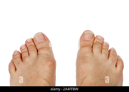 Long toenails. Isolate on a white background Stock Photo