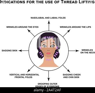 Indications for the use of thread lifting. Mesotherapy Wrinkles. Infographics. Vector illustration on isolated background. Stock Vector
