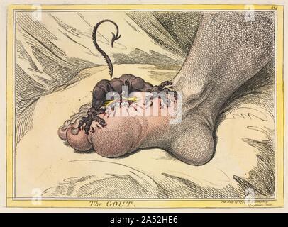 The Gout, 1799. Stock Photo