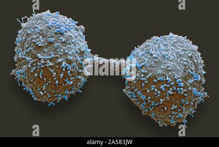 Dividing prostate cancer cells, SEM Stock Photo