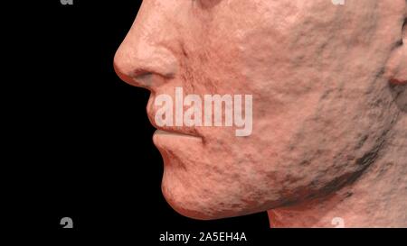 Skin Problems : old, cracked, dry skin on face . 3d render Stock Photo