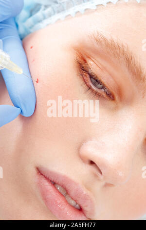 Cosmetology Service. Young woman at beauty clinic lying while doctor in gloves doing injection of hyaluronic acid into mark on cheek face close-up Stock Photo