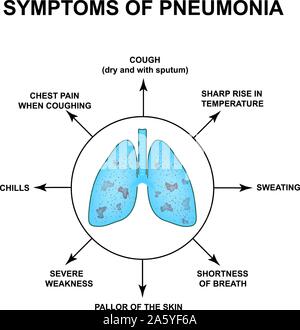 Pneumonia of the Lungs diagram illustration Stock Vector Art ...