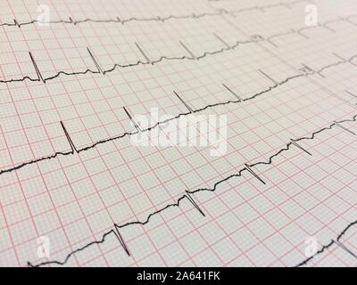 Close up of Electrocardiogram, Electrocardiography or EKG chart using for fetal heart monitoring. diagnostic, healthcare, medical service. Stock Photo