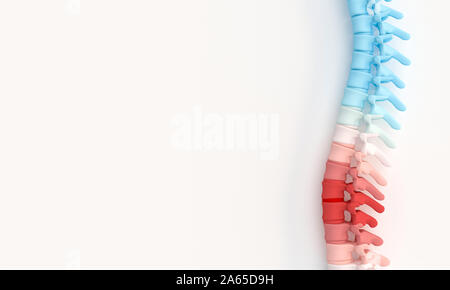 3d illustration render of a spine with highlighted aching parts. Back care concept. Stock Photo