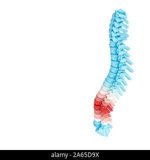 3d illustration render of a spine with highlighted aching parts. Back care concept.