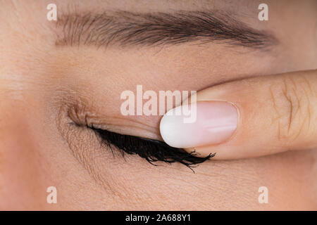 Close Up Of A Woman Massaging Infected Eye Stock Photo